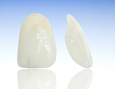 Porcelain Veneers can fix multiple imperfections with just one simple procedure